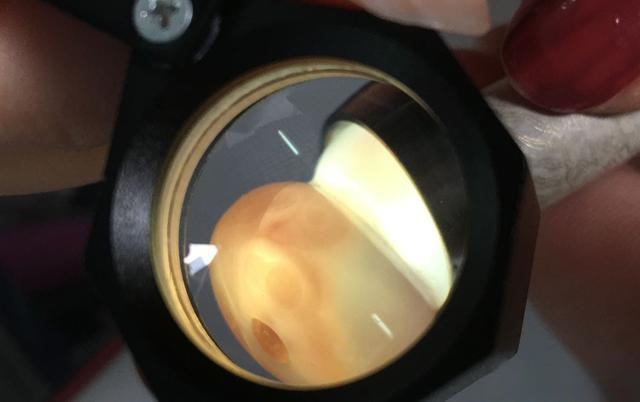 Magnified view of Icedrift Nan Red Agate showing characteristic cinnabar spots