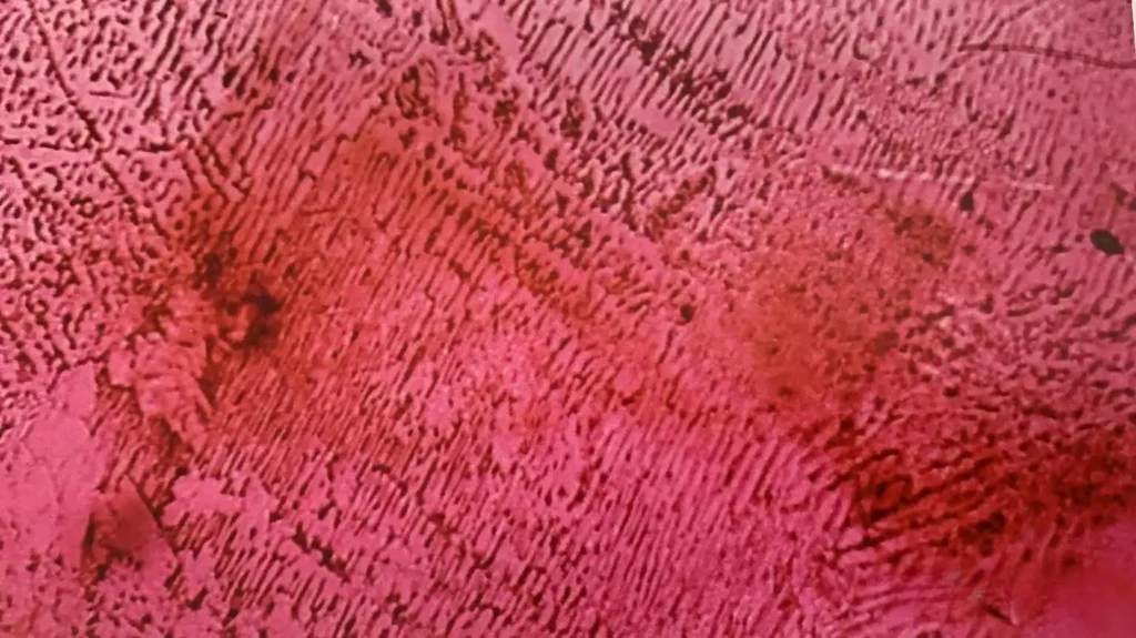 Microscopic view of a net-like fluid fingerprint inclusion within a Sri Lankan ruby.