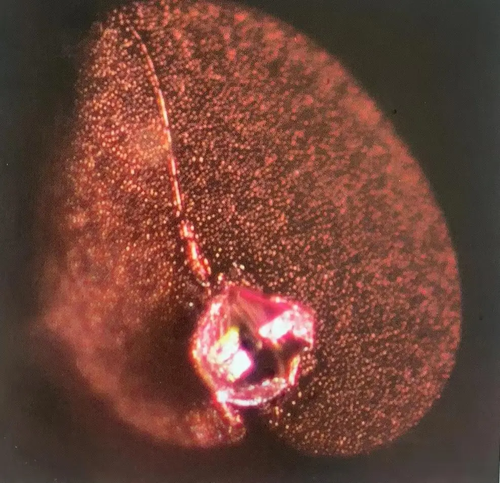 A spinel inclusion with surrounding tension fractures inside a Mogok spinel